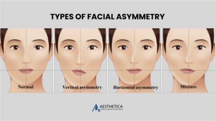 Are asymmetrical faces more attractive?