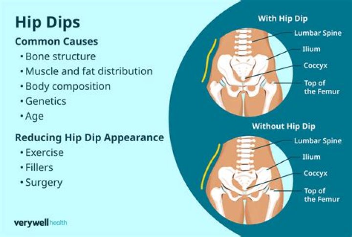 Are hip dips natural?