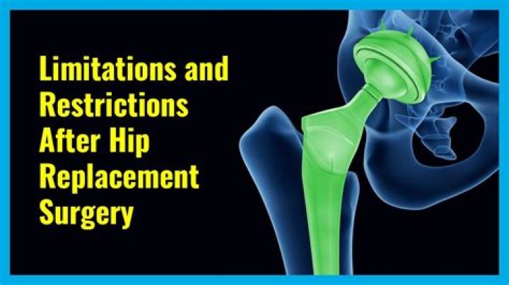 Are there permanent restrictions after hip replacement?