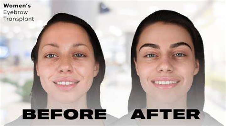 Are thicker eyebrows better?