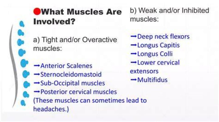 Are tight muscles weak or strong?