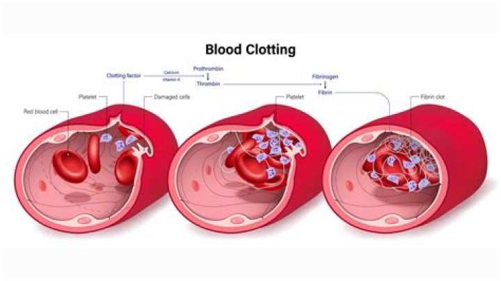 Can amoxicillin cause blood clots?
