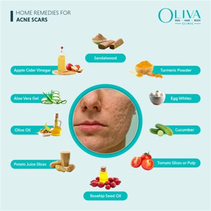 Can carrots cure acne?