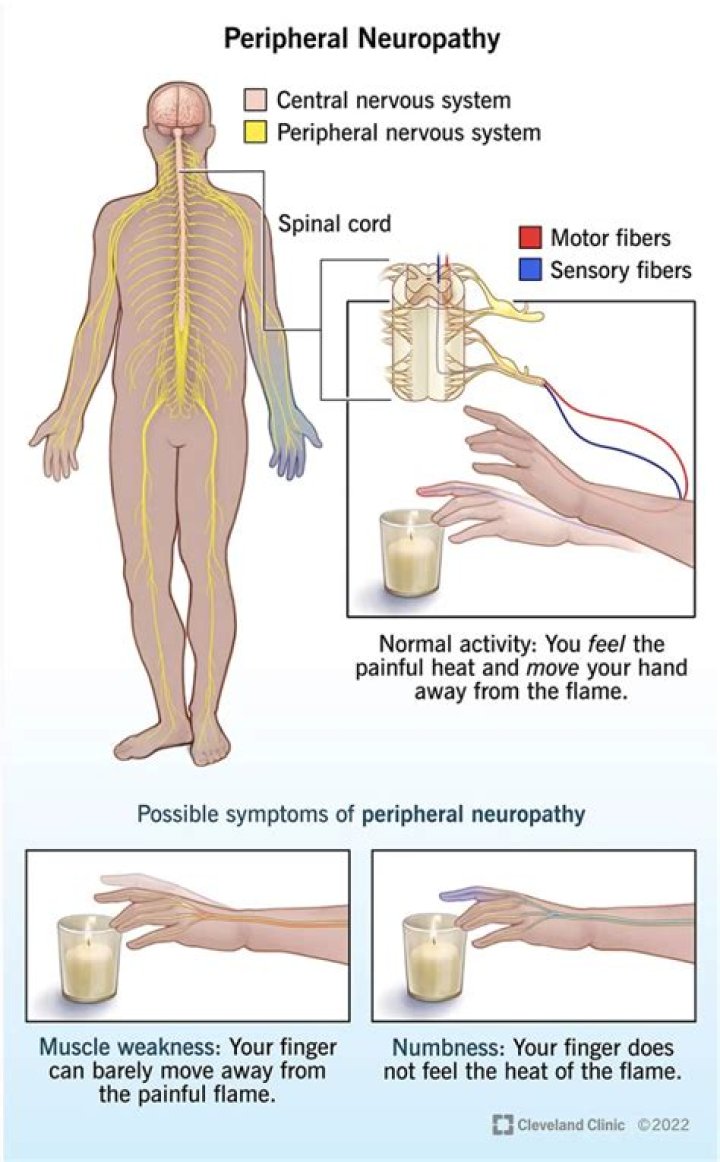 Can CBD heal neuropathy?