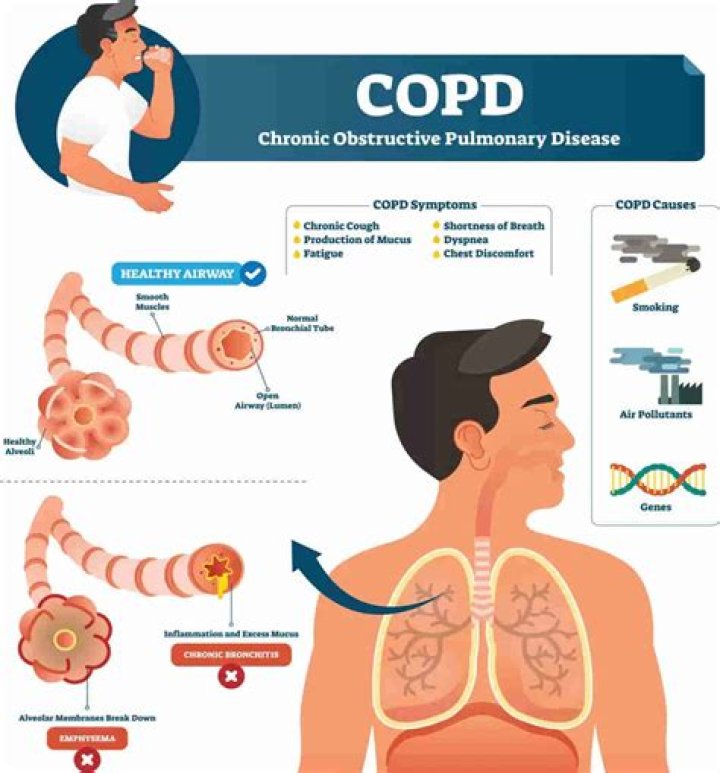 Can COPD symptoms come and go?