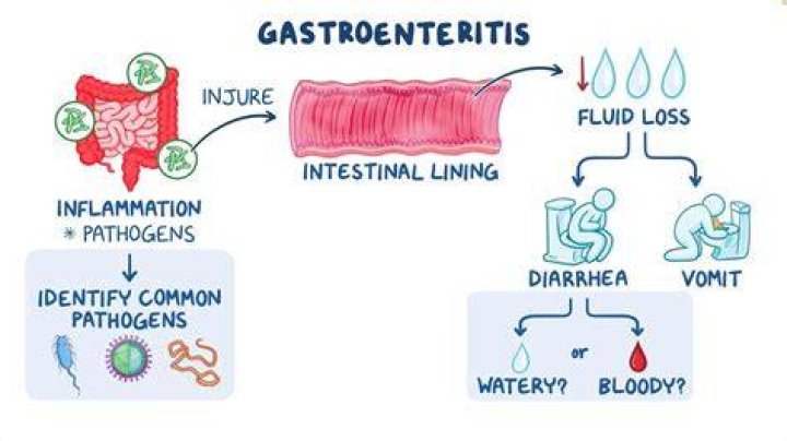 Can gastroenteritis cause fatigue?
