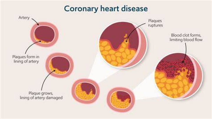 Can Gatorade affect your heart?