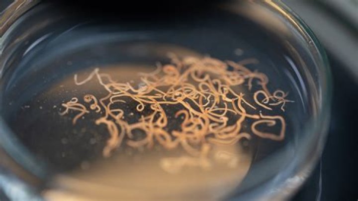 Can humans get worms from chicken eggs?