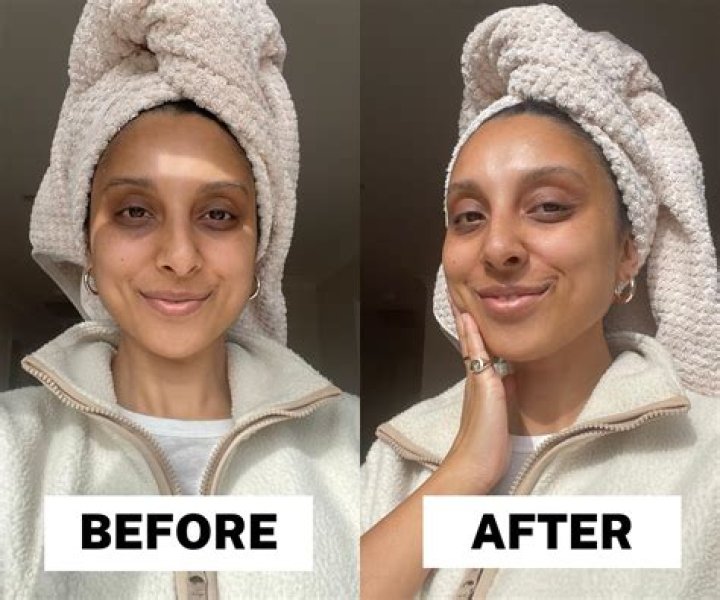 Can I apply turmeric on my face everyday?