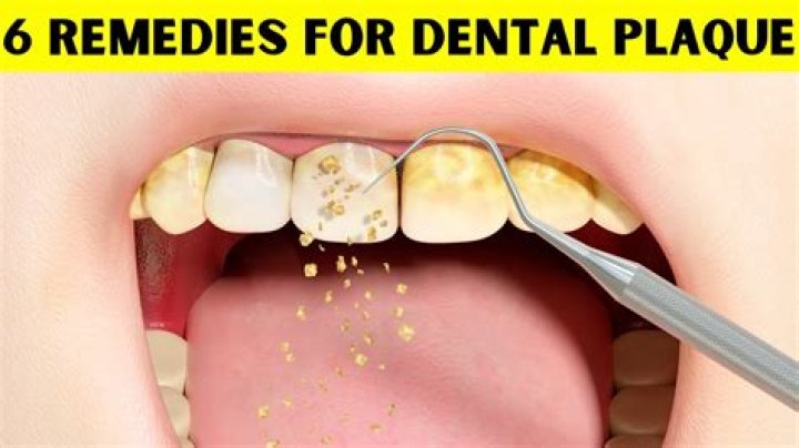 Can I scrape plaque off my teeth?