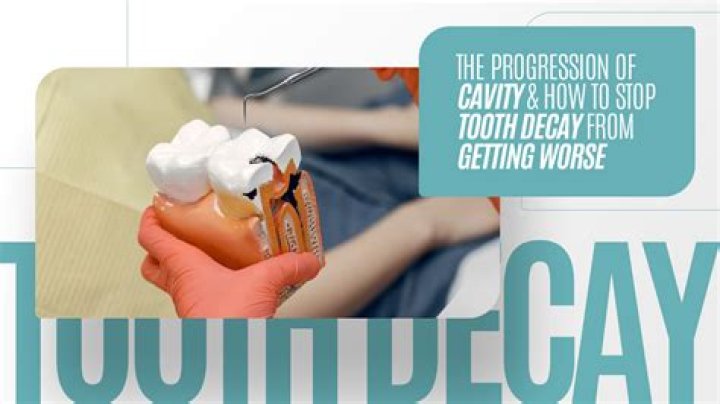 Can I stop a cavity from getting worse?
