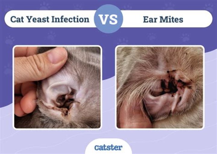 Can lice get in your ears?