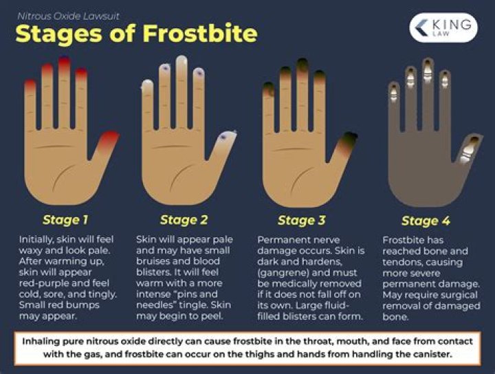Can minor frostbite cause nerve damage?