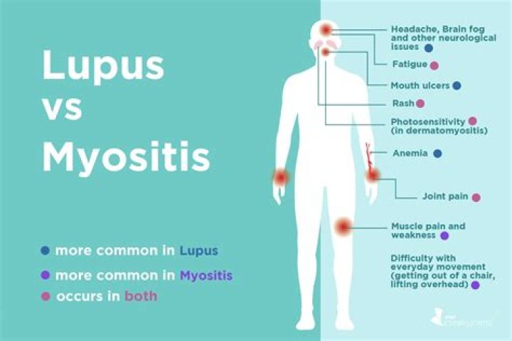 Can myositis cause chest pain?
