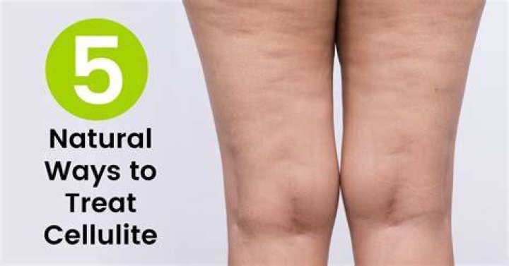 Can oils help with cellulite?