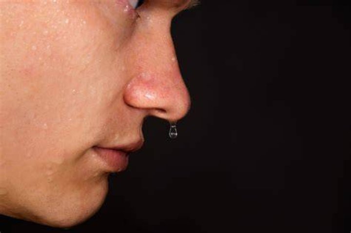 Can pieces of your brain come out your nose?
