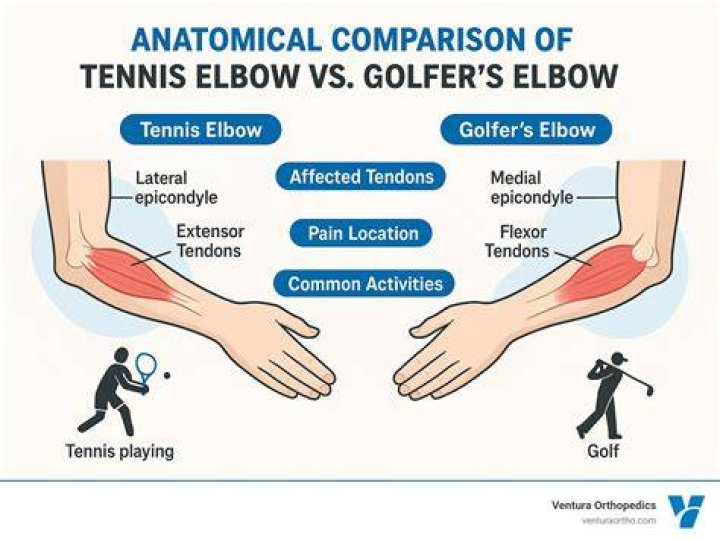 Can push ups cause golfer's elbow?