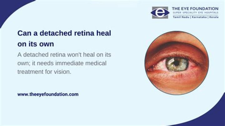 Can retina repair itself?
