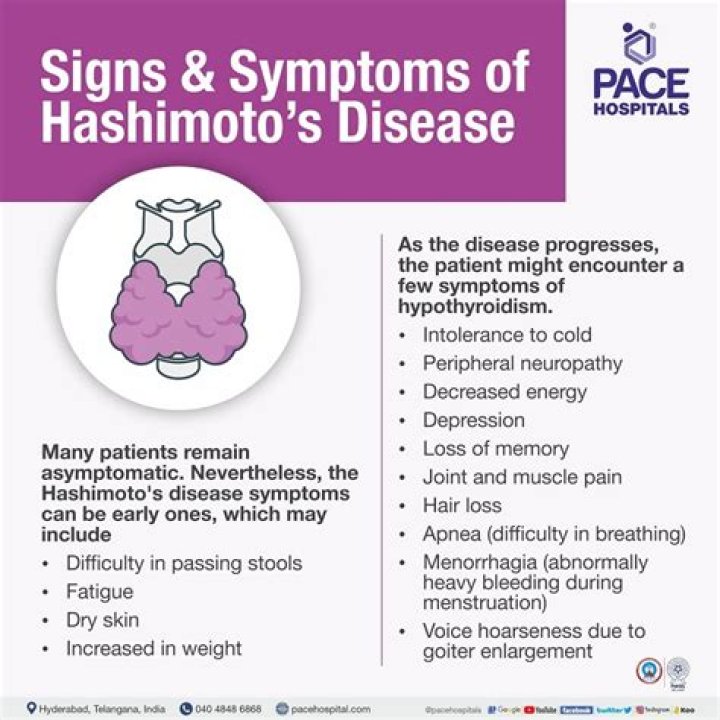 Can Sjogren's cause Hashimoto's?