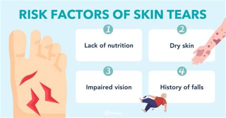 Can tears stain your face?