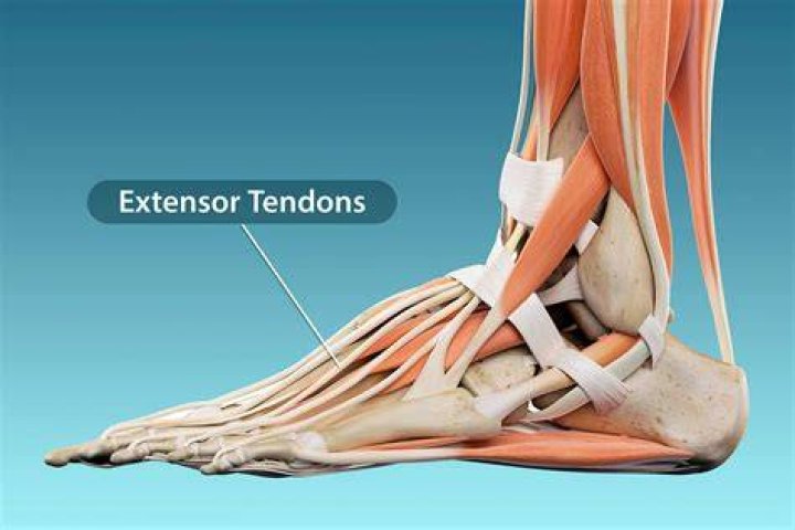 Can tendonitis last for years?