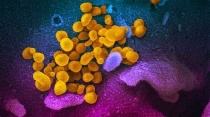 Can the coronavirus survive on surfaces?