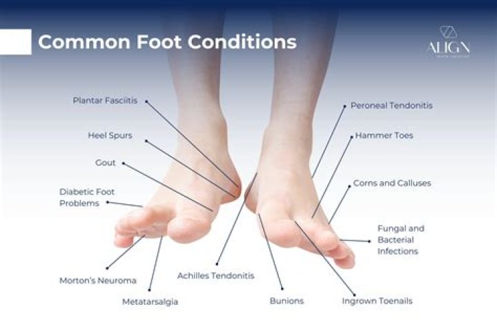Can toe walking cause problems?