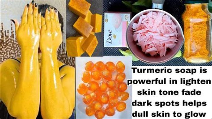 Can turmeric and curd remove dark spots?