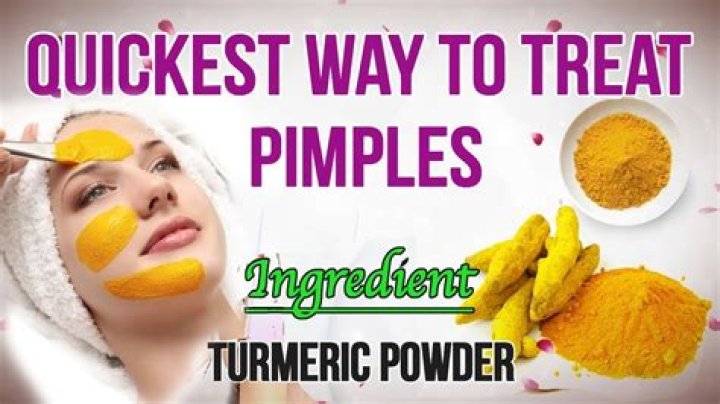 Can turmeric remove pimples?