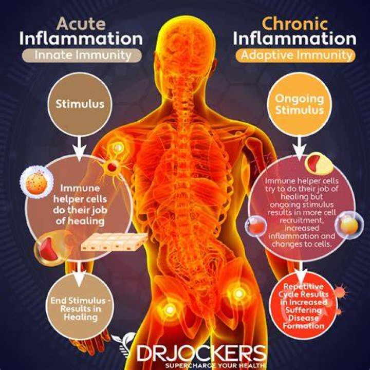 Can walking too much cause inflammation?