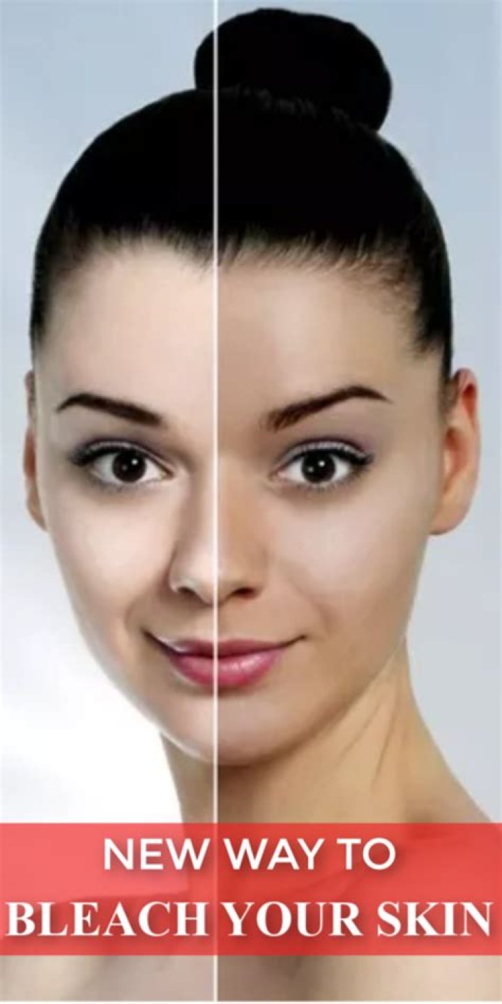 Can you bleach your skin?