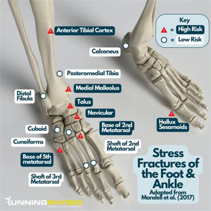 Can you break your foot and still walk?