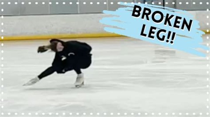 Can you break your leg skiing?