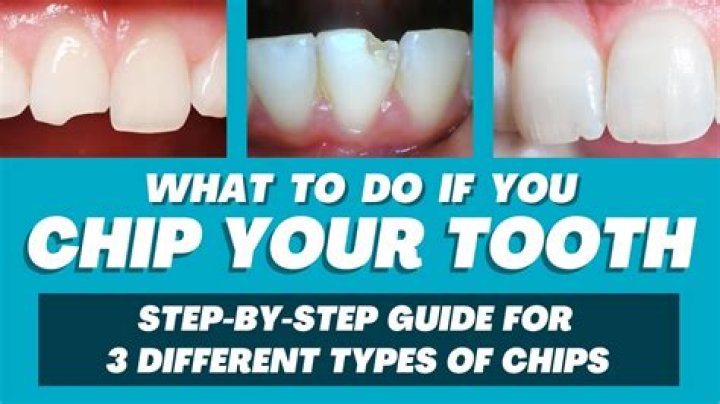 Can you chip with a gap wedge?