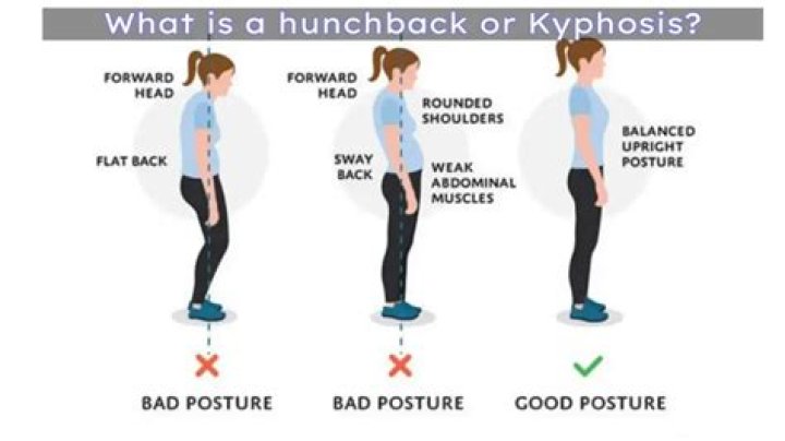 Can you correct a hunched back?