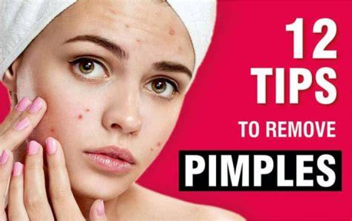 Can you get pimples from kissing?