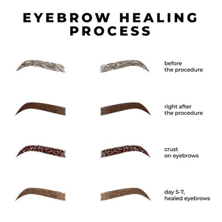 Can you have an MRI scan after Microblading?