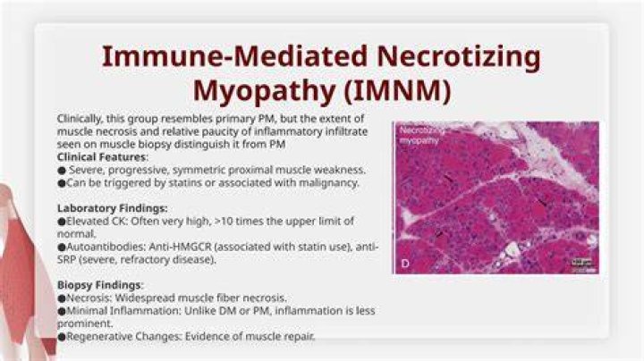 Can you recover from necrotizing myopathy?