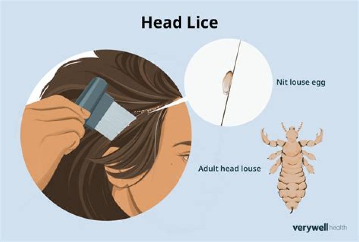 Can you see lice in your hair?