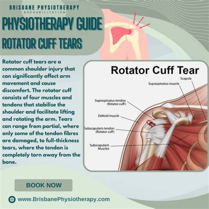 Can you still throw a baseball with a torn rotator cuff?