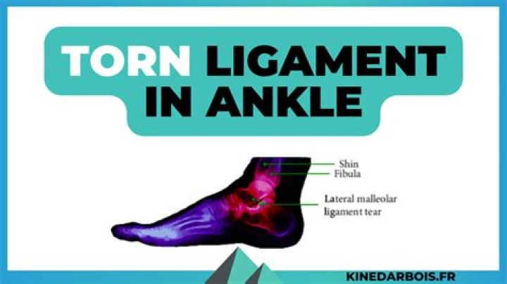 Do ankle ligaments heal on their own?