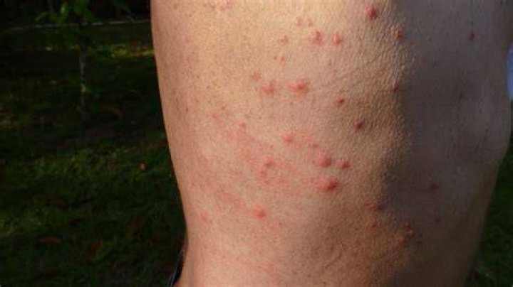 Do dog bites leave scars?