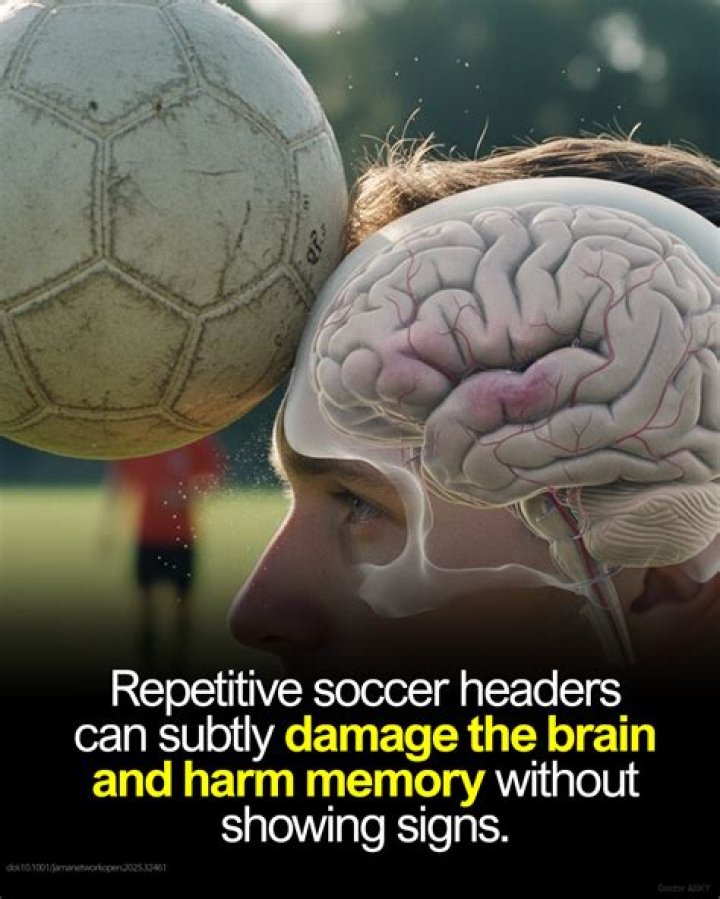 Do headers in soccer cause brain damage?