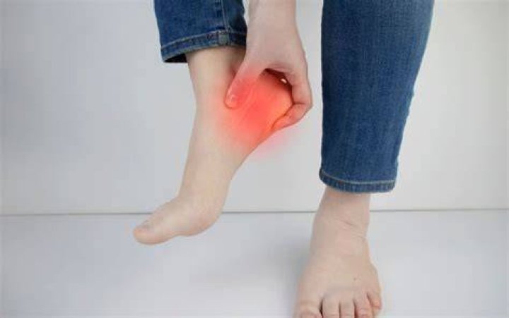 Do heel cups help plantar fasciitis?