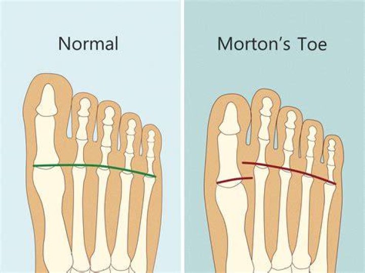 Do I need more or less toe hang?