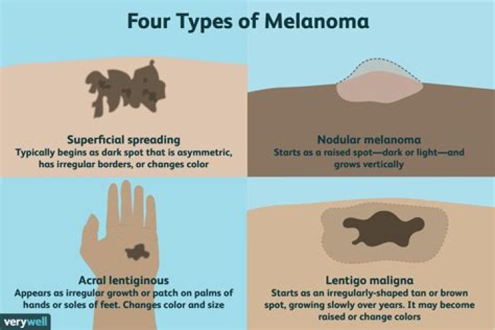 Do melanomas itch?