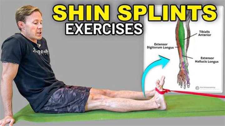Do shin splints get better with exercise?
