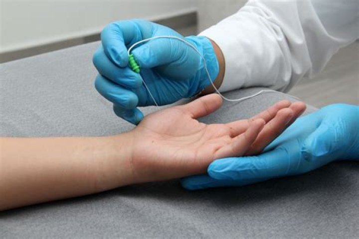 Do you need a driver after an EMG?