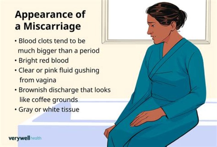 Does a miscarriage start with brown spotting?