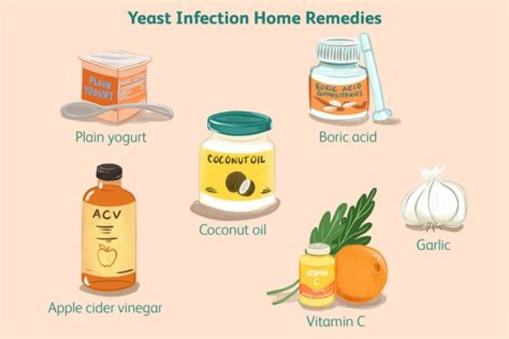 Does baking soda help a yeast infection?